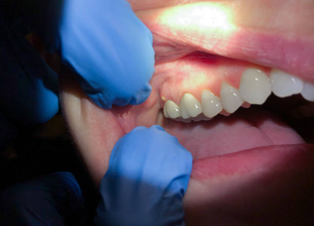 Best Emergency Dentist for Special Needs Patients in Bentonville, AR