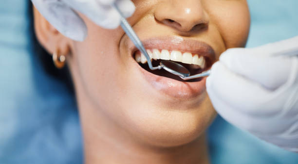 Best Emergency Dentist for Lost Fillings or Crowns in Bentonville, AR