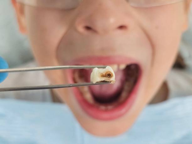 Best Emergency Cosmetic Dentistry in Bentonville, AR